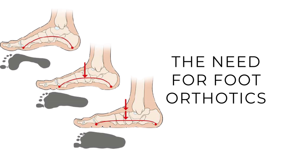 The Need for Foot Orthotics