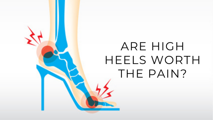 Are High Heels Worth The Pain?